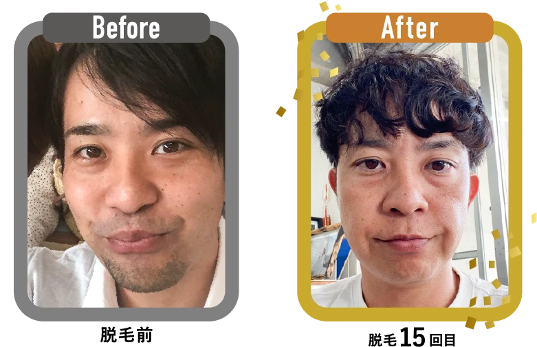 Before After